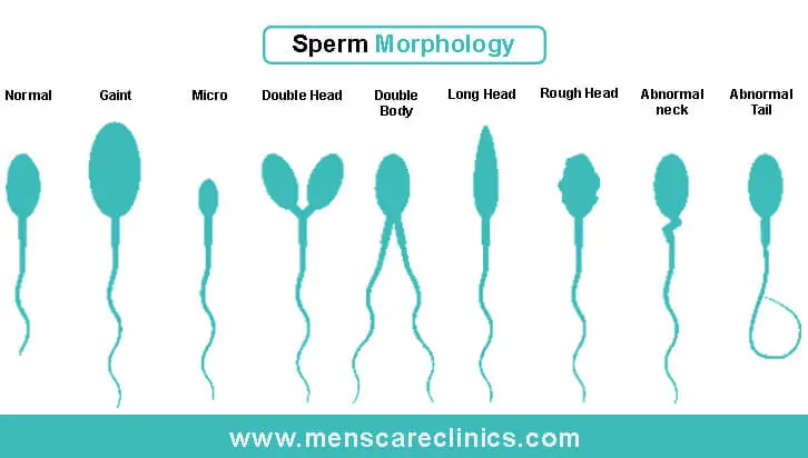 Sperm-Marphology_Shape_