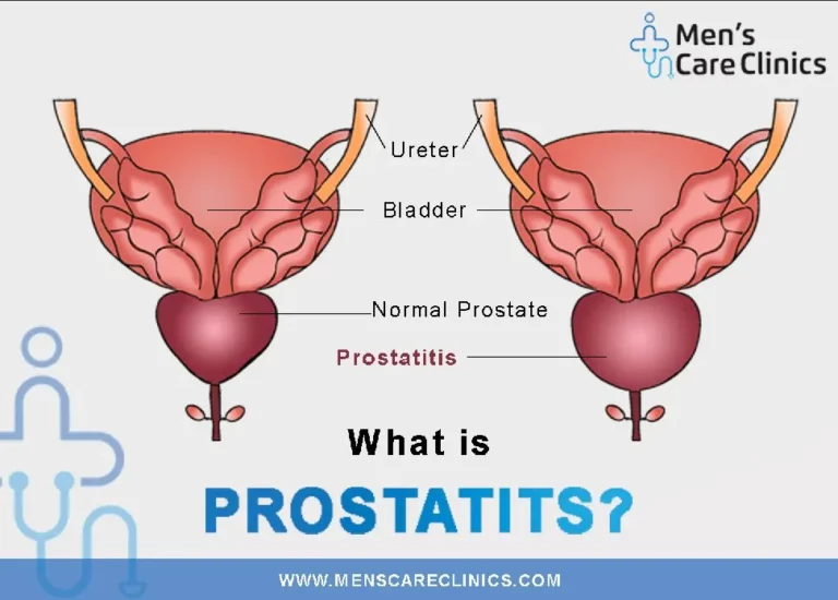 Prostatitis